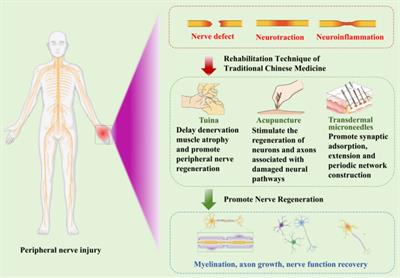 Advances in novel biomaterials combined with traditional Chinese medicine rehabilitation technology in treatment of peripheral nerve injury